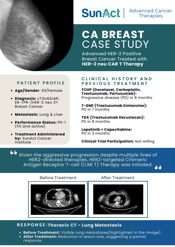 SunAct breast cancer case study showcasing HER2-positive treatment with CAR T-cell therapy