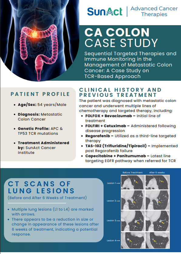 SunAct colon cancer case study highlighting TCR-based approach in metastatic colon cancer with lung lesions