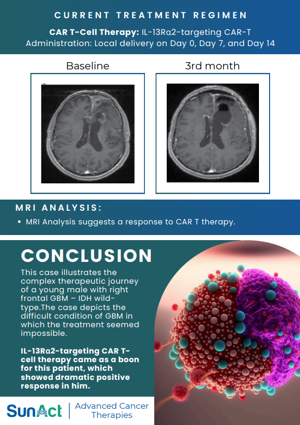 SunAct CNS case study on GBM treatment using multiple gene mutation targeting in a 36-year-old male