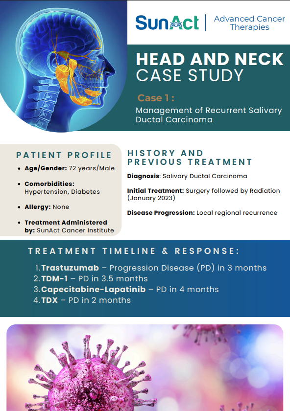 SunAct head and neck cancer case study on salivary ductal carcinoma managed with advanced therapies