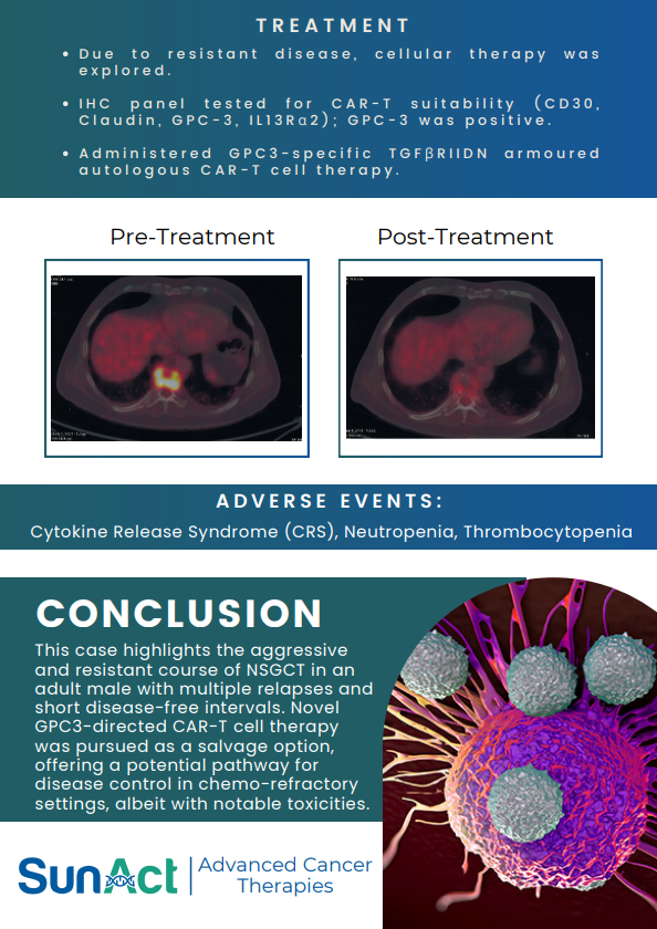 SunAct genitourinary cancer case study on GPC3-targeted CAR T therapy for refractory non-seminomatous germ cell tumor
